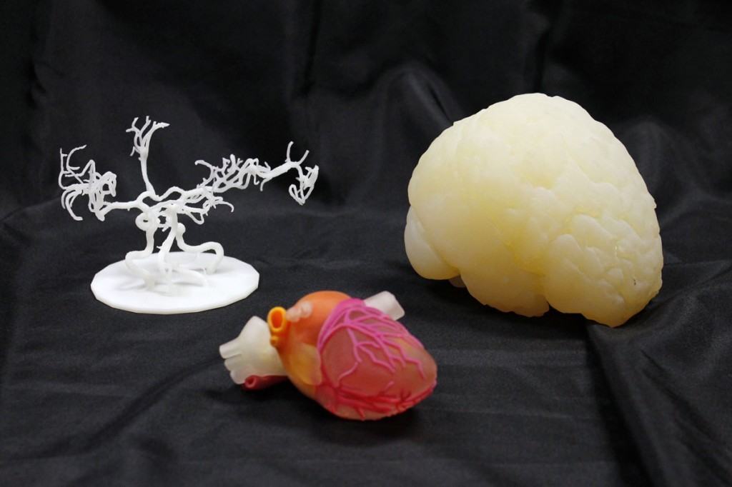 3D-Ops-3D-printed-surgical-models-1024x682