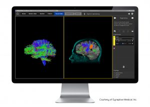 Brain Surgery Solution Brings Canadian High Tech Company Life Science Award