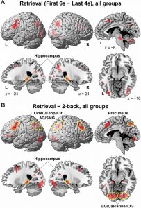 scientific diagram shows human brain activity readings