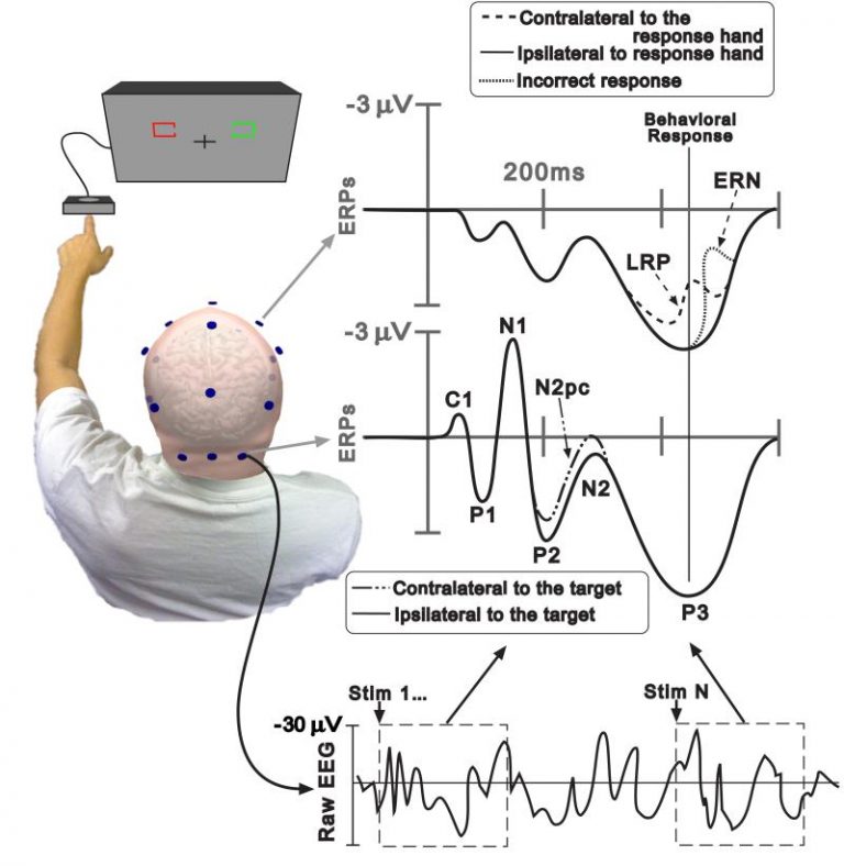 Canadian Tech Tracks Brain Health, Cognitive Functions | WhatsYourTech.ca