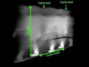 x ray type scan shows gait analysis
