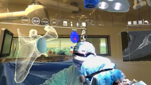 surgeons at work in operating room with 3-D visualization of shoulder superimposed on image